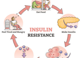 Insulin resistance test may help predict early Alzheimer’s cognitive decline rate